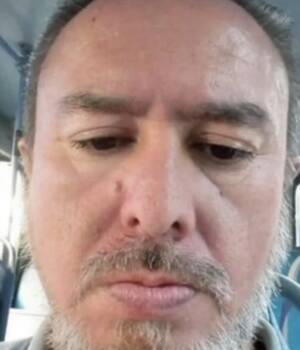 Andoni
